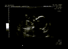 MYLENE20.gif (3866 bytes)