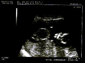 MYLENE12.gif (6928 bytes)